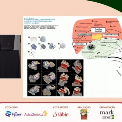 Confira a gravação completa do Simpósio Norte-Paranaense de Cardiologia 2022